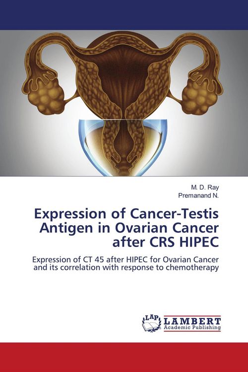 Produktbild: Expression of Cancer-Testis Antigen in Ovarian Cancer after CRS HIPEC