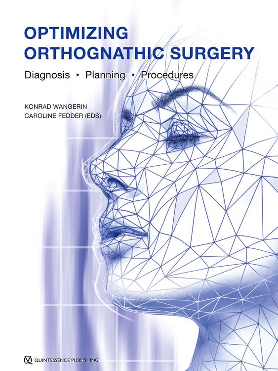 Produktbild: Optimizing Orthognathic Surgery