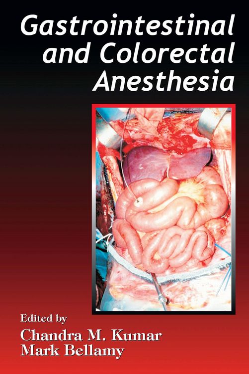 Produktbild: Gastrointestinal and Colorectal Anesthesia