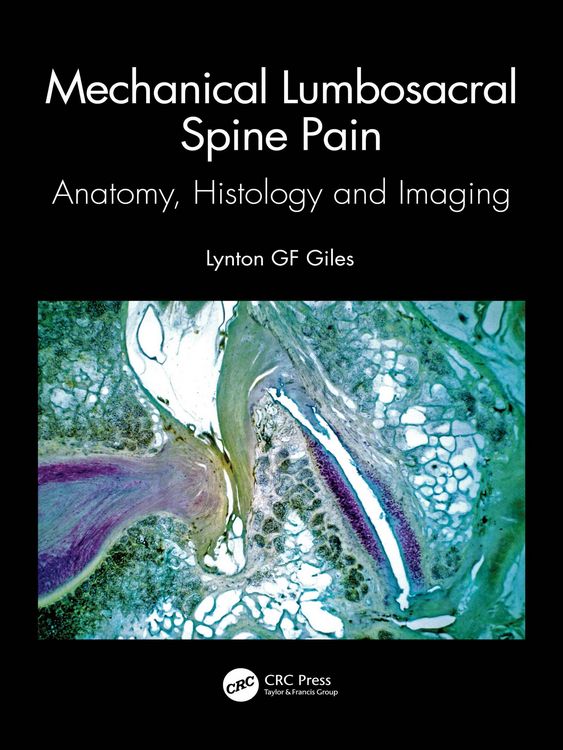 Produktbild: Mechanical Lumbosacral Spine Pain