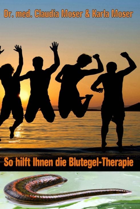Produktbild: So hilft ihnen die Blutegeltherapie