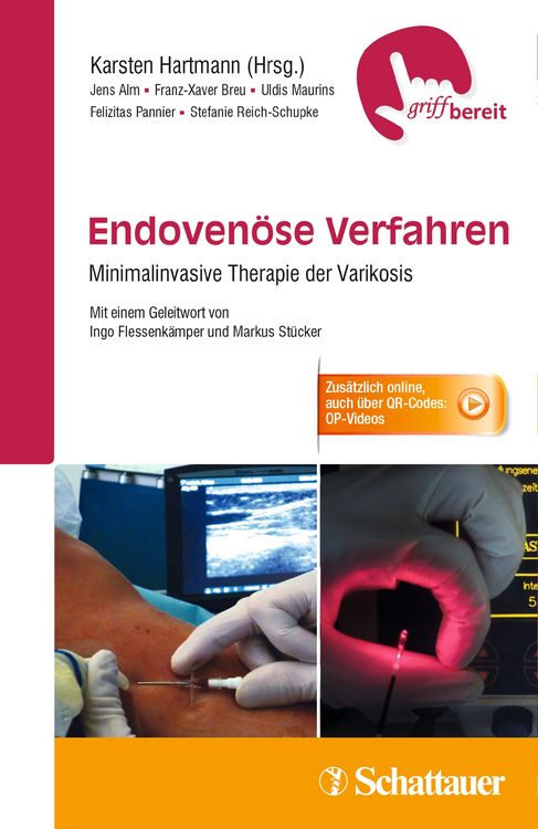 Produktbild: Endoven&ouml;se Verfahren