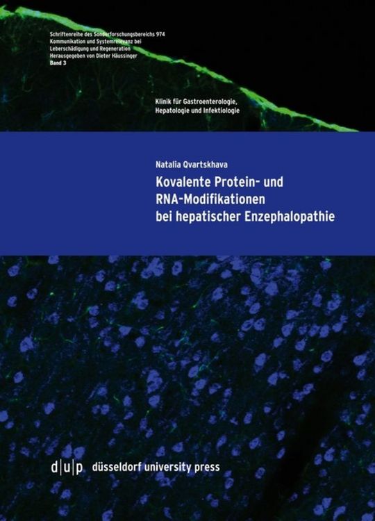 Produktbild: Kovalente Protein- und RNA-Modifikationen bei hepatischer Enzephalopathie