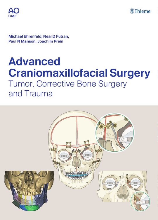 Produktbild: Advanced Craniomaxillofacial Surgery