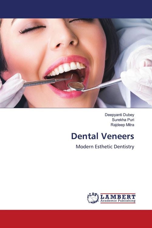 Produktbild: Dental Veneers