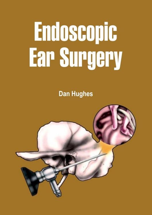 Produktbild: Endoscopic Ear Surgery