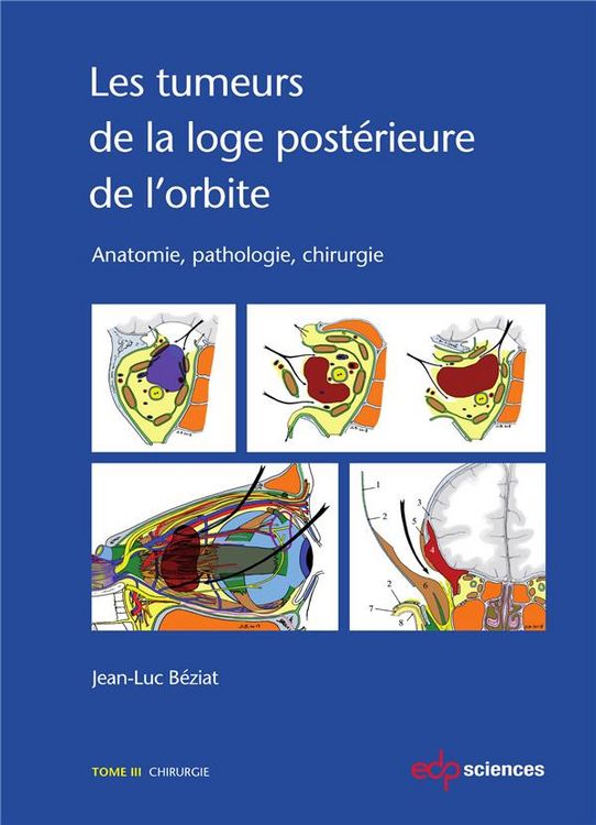 Produktbild: Les tumeurs de la loge post&eacute;rieure de l'orbite