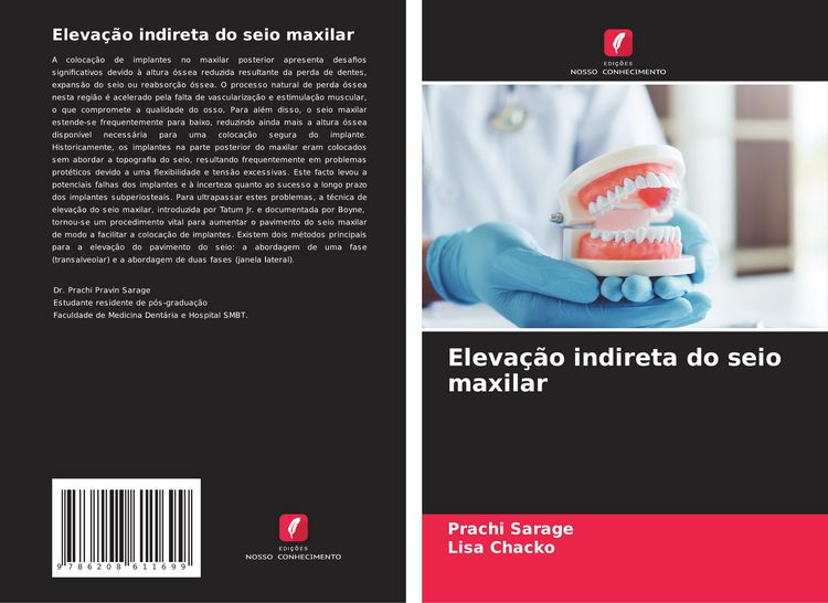 Produktbild: Eleva&ccedil;&atilde;o indireta do seio maxilar