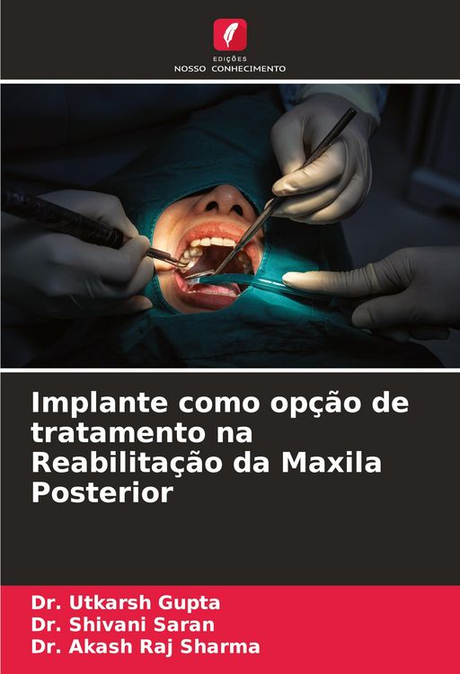 Produktbild: Implante como op&ccedil;&atilde;o de tratamento na Reabilita&ccedil;&atilde;o da Maxila Posterior