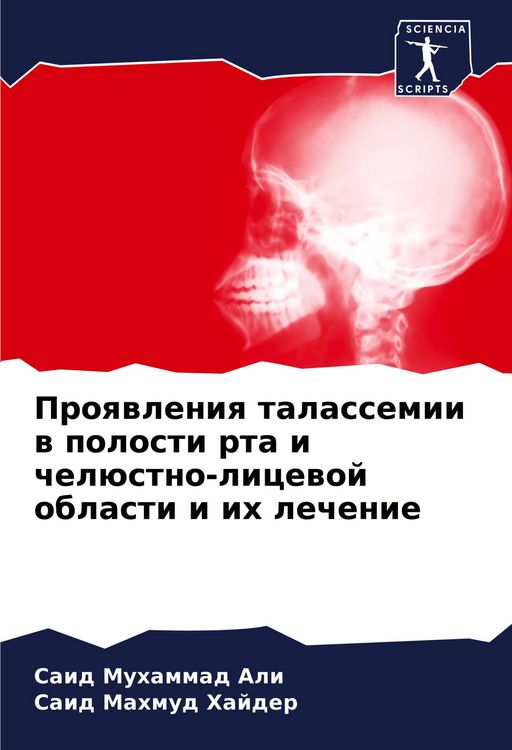 Produktbild: Proqwleniq talassemii w polosti rta i chel&uuml;stno-licewoj oblasti i ih lechenie