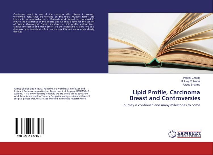 Produktbild: Lipid Profile, Carcinoma Breast and Controversies