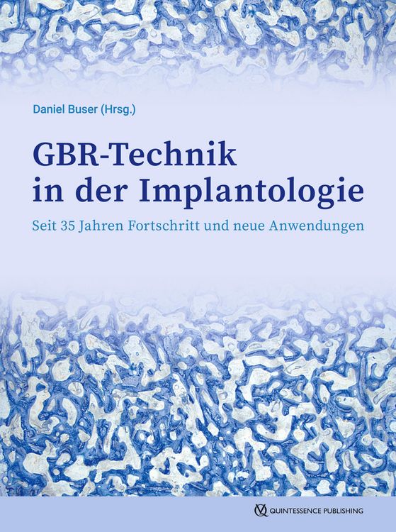 Produktbild: GBR-Technik in der Implantologie