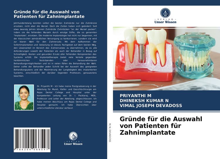 Produktbild: Gr&uuml;nde f&uuml;r die Auswahl von Patienten f&uuml;r Zahnimplantate