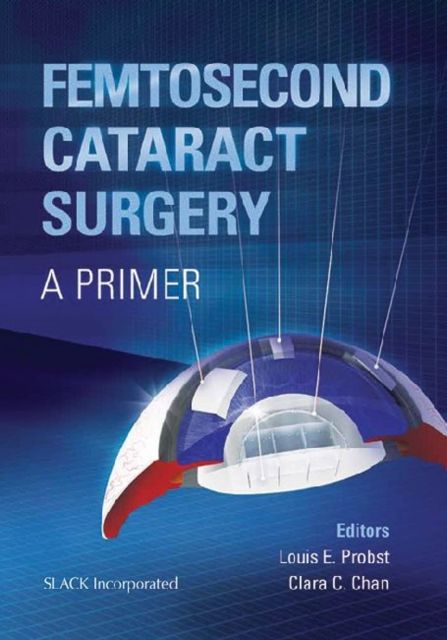 Produktbild: Probst, L: Femtosecond Cataract Surgery