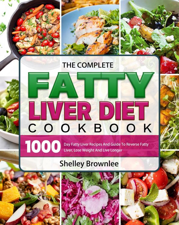 Produktbild: The Complete Fatty Liver Diet Cookbook