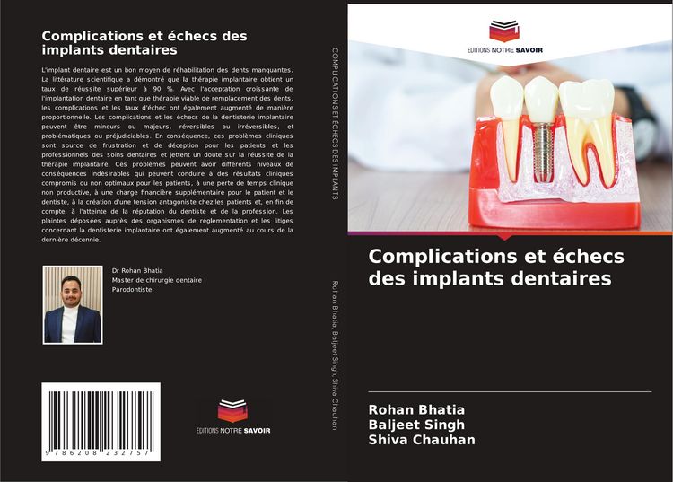 Produktbild: Complications et &eacute;checs des implants dentaires