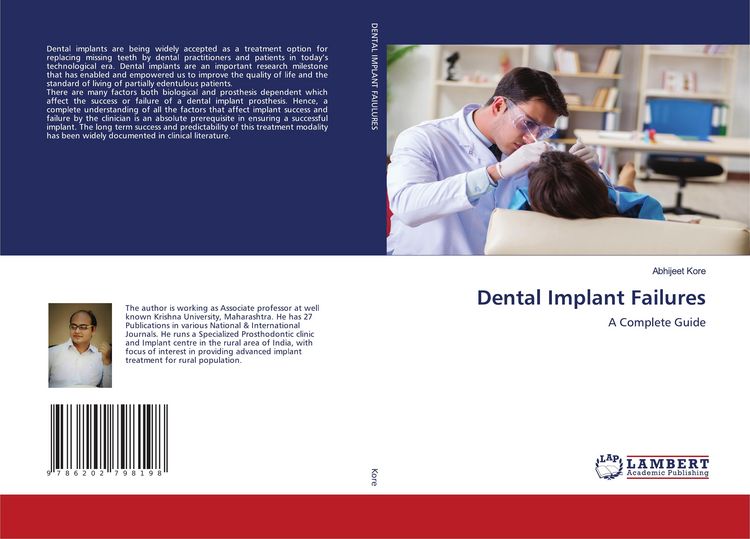 Produktbild: Dental Implant Failures