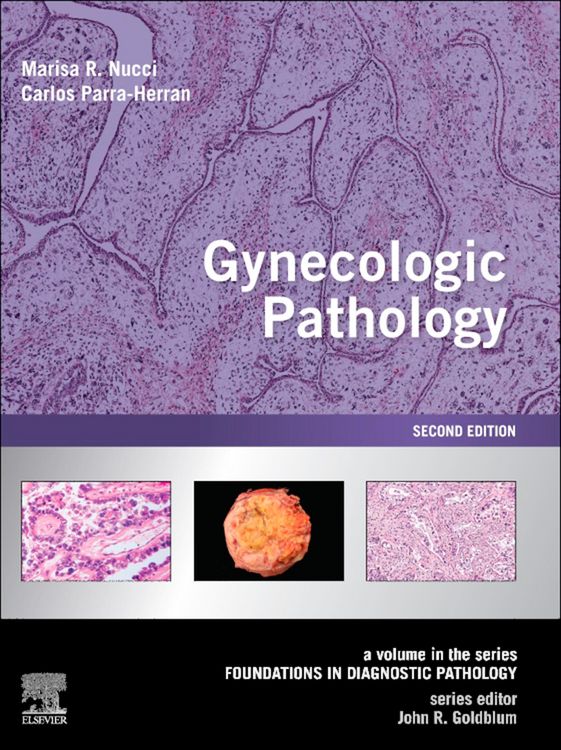 Produktbild: Gynecologic Pathology E-Book