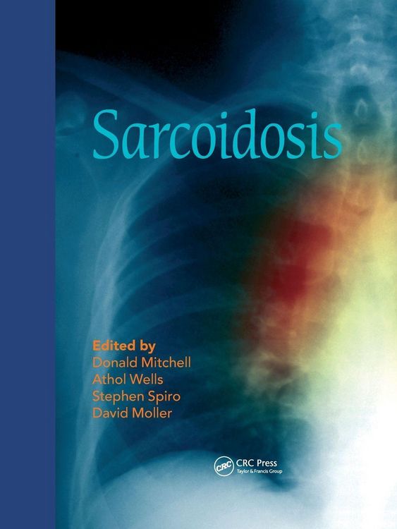 Produktbild: Sarcoidosis