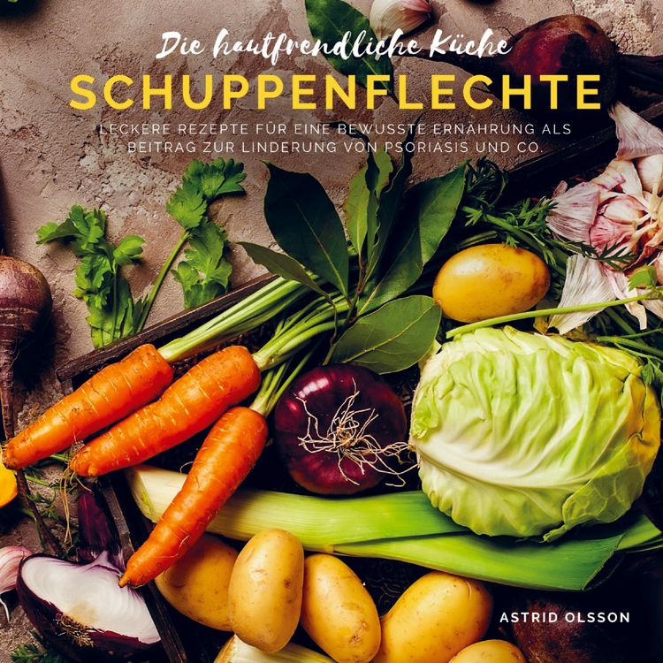 Produktbild: Die hautfreundliche K&uuml;che - Schuppenflechte