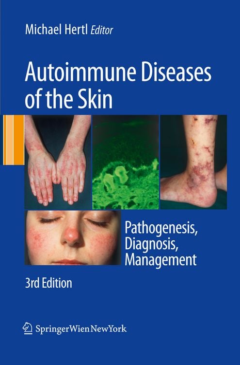 Produktbild: Autoimmune Diseases of the Skin