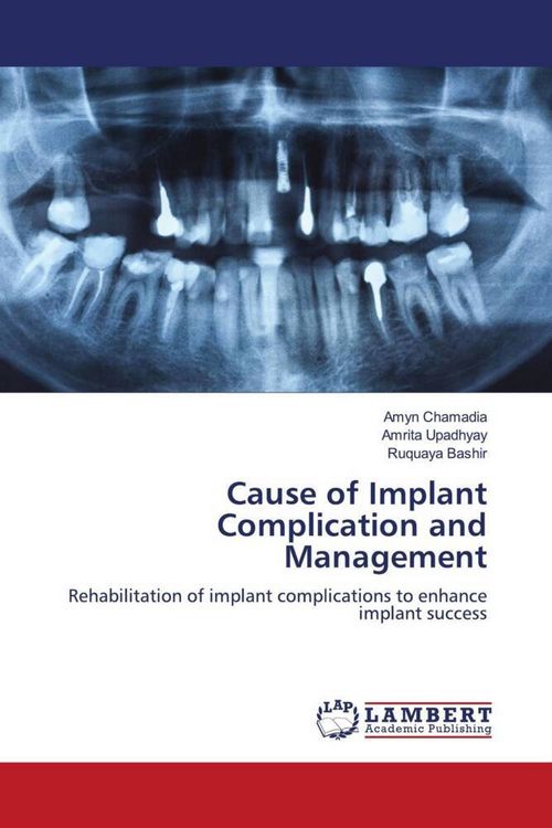 Produktbild: Cause of Implant Complication and Management