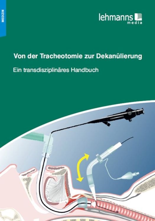Produktbild: Von der Tracheotomie zur Dekan&uuml;lierung