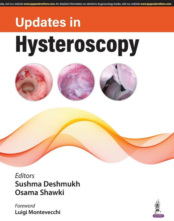 Produktbild: Updates in Hysteroscopy