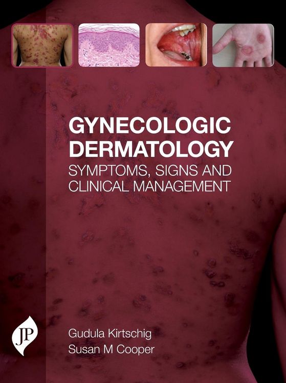 Produktbild: Gynecologic Dermatology