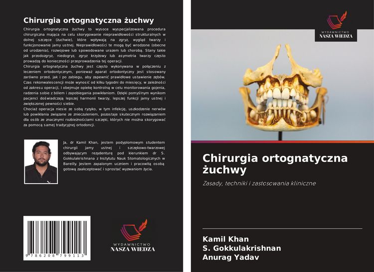 Produktbild: Chirurgia ortognatyczna &iquest;uchwy