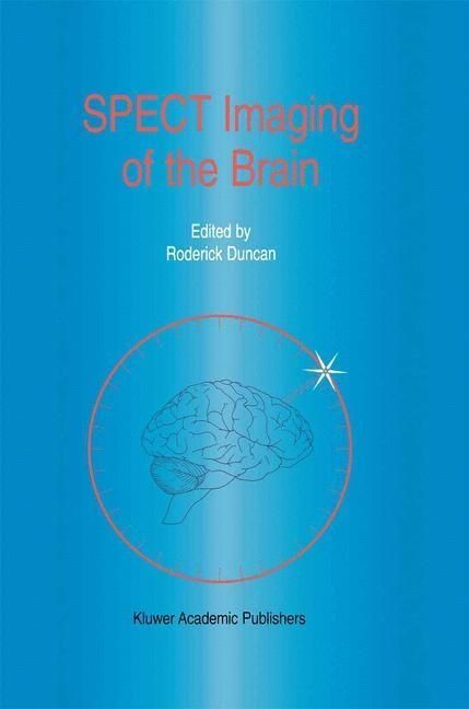 Produktbild: SPECT Imaging of the Brain