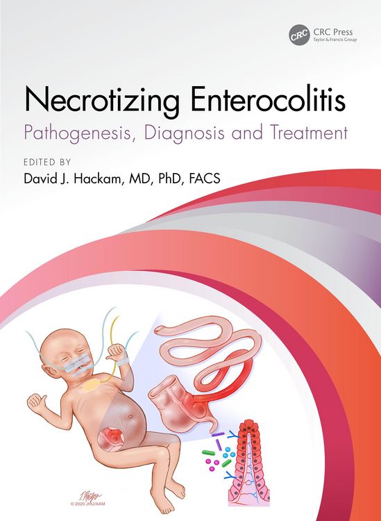 Produktbild: Necrotizing Enterocolitis