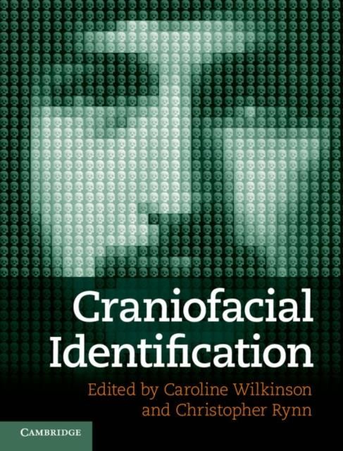 Produktbild: Craniofacial Identification