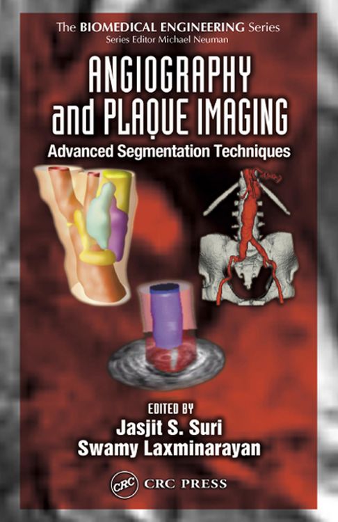 Produktbild: Angiography and Plaque Imaging