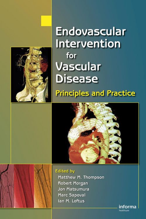 Produktbild: Endovascular Intervention for Vascular Disease
