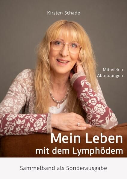 Produktbild: Mein Leben mit dem Lymph&ouml;dem