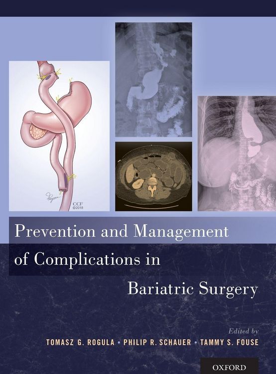 Produktbild: Prevention and Management of Complications in Bariatric Surgery