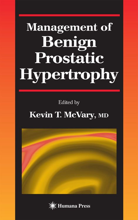 Produktbild: Management of Benign Prostatic Hypertrophy