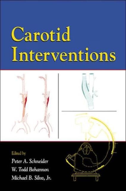 Produktbild: Carotid Interventions