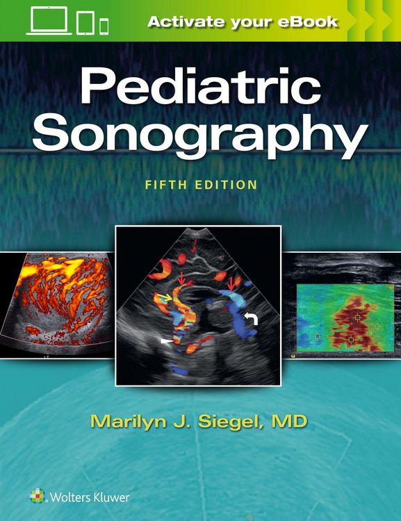 Produktbild: Siegel, M: Pediatric Sonography