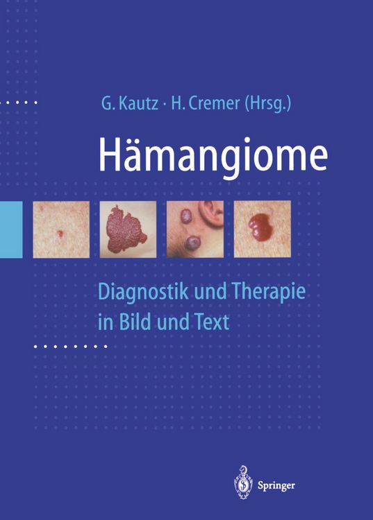 Produktbild: H&auml;mangiome