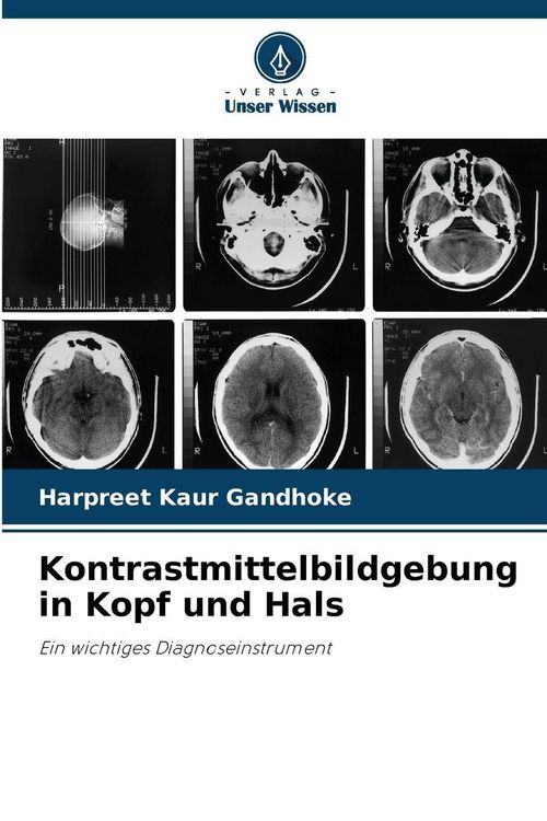 Produktbild: Kontrastmittelbildgebung in Kopf und Hals