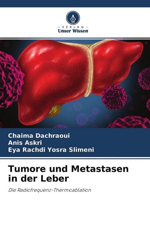 Produktbild: Tumore und Metastasen in der Leber