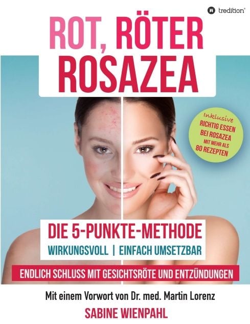 Produktbild: Rot R&ouml;ter Rosazea