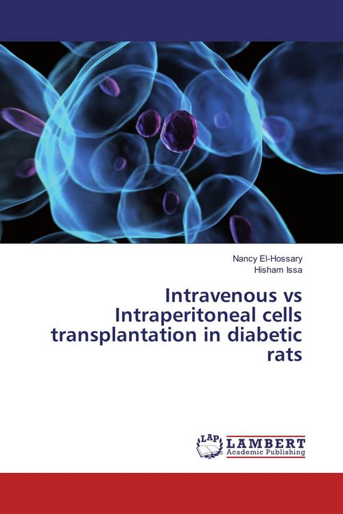 Produktbild: Intravenous vs Intraperitoneal cells transplantation in diabetic rats