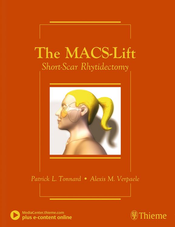 Produktbild: The MACS-Lift