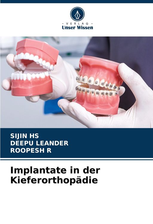 Produktbild: Implantate in der Kieferorthop&auml;die