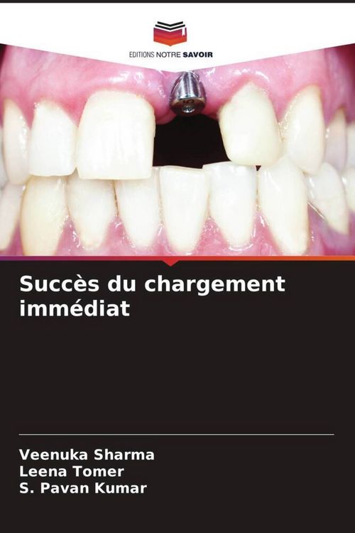 Produktbild: Succ&egrave;s du chargement imm&eacute;diat