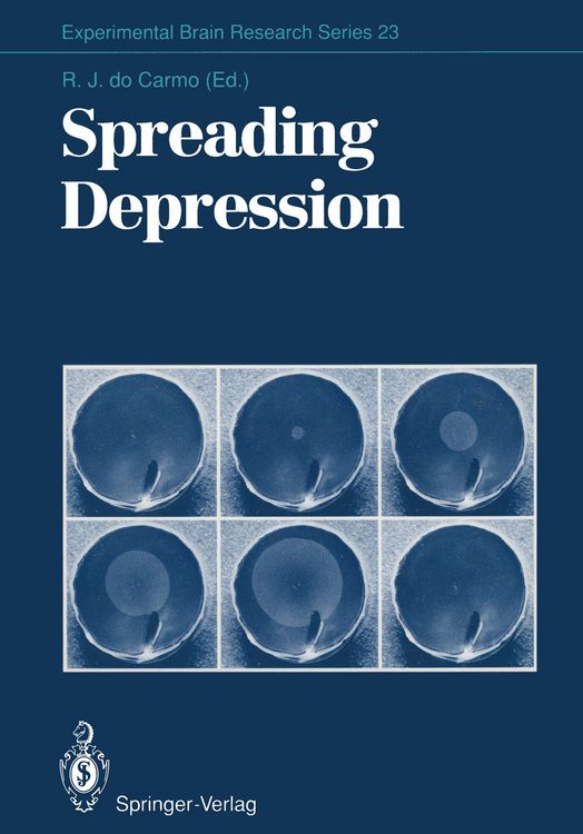 Produktbild: Spreading Depression
