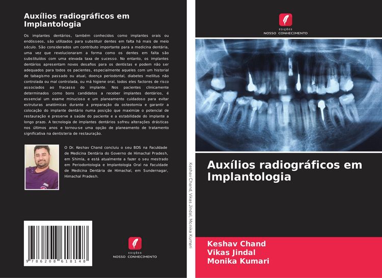 Produktbild: Aux&iacute;lios radiogr&aacute;ficos em Implantologia